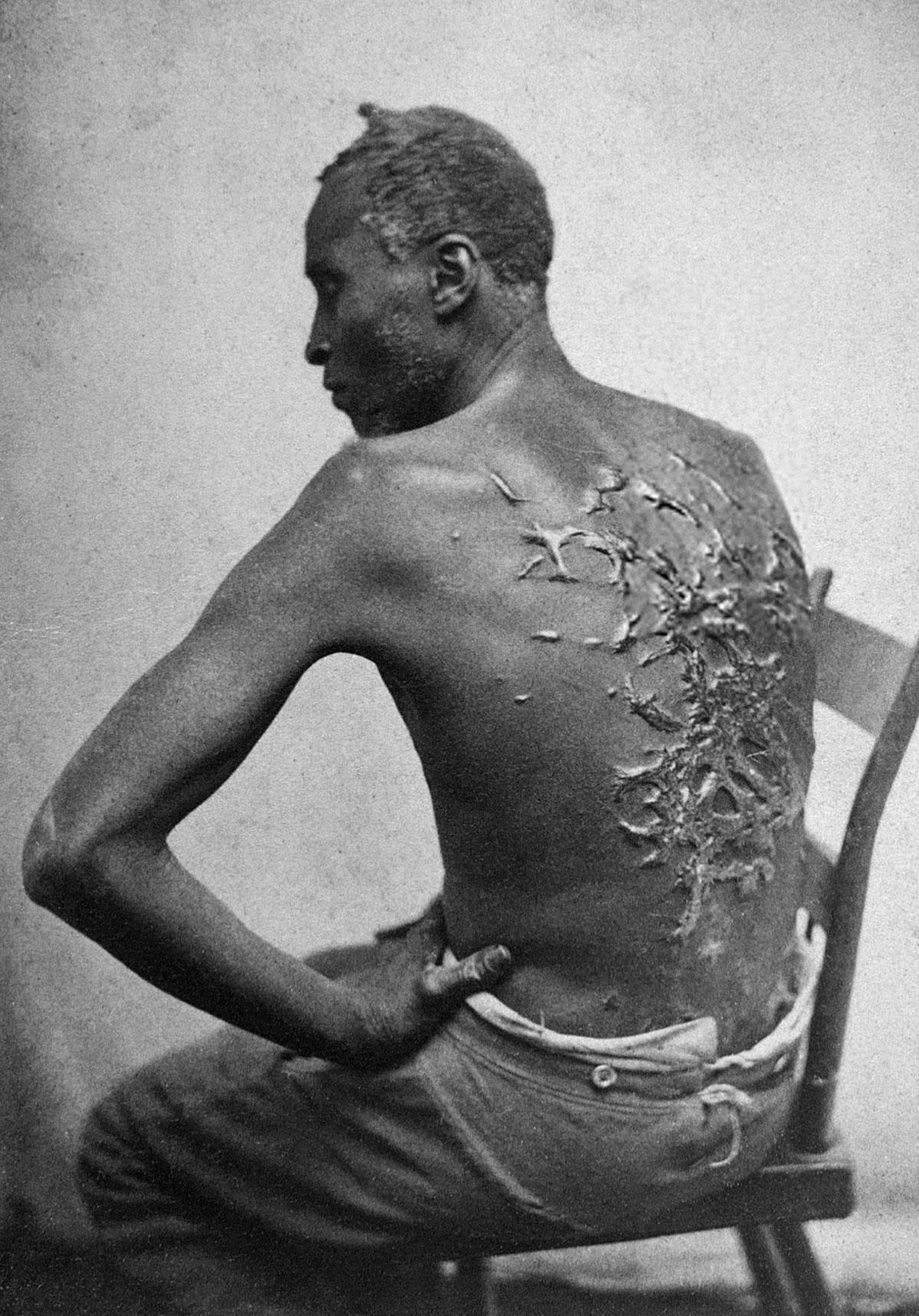 0710 Scourged back by McPherson Oliver 1863 retouched - Dualismus der Freiheiten - UZ vom 16. Februar 2024 - UZ vom 16. Februar 2024